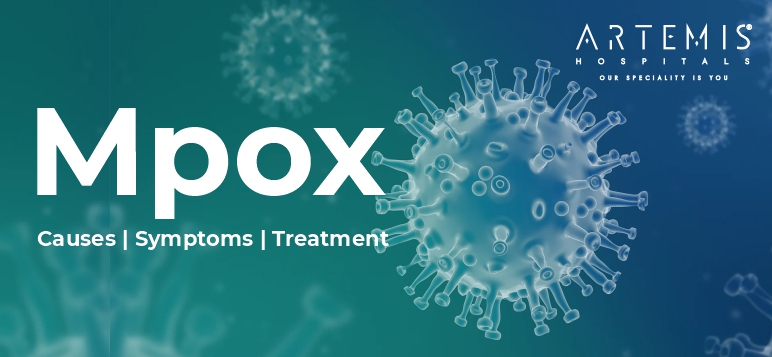 mpox-causes-symptoms-treatment