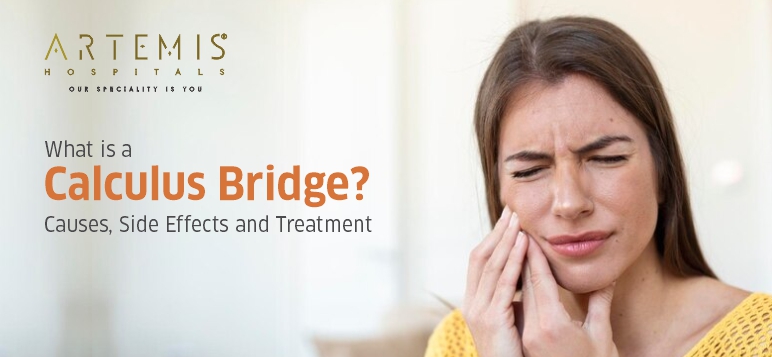 what-is-a-calculus-bridge-causes-side-effects-and-treatment