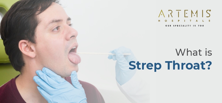 What is Strep Throat? Symptoms, Causes, and Treatments